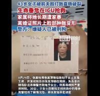 女子遭前夫毆打致腸破裂住進ICU 警方回應女子被前夫打進ICU